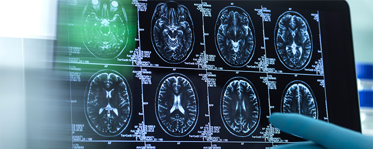 Current Trends in Addiction Counseling